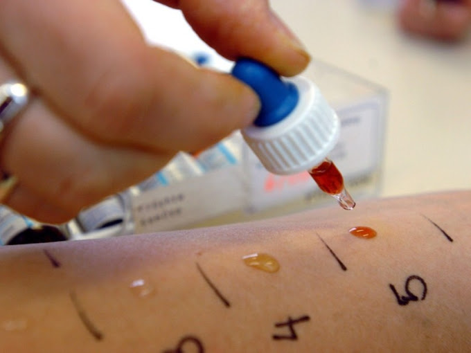 ΙΑΤΡΟΣ ΑΛΛΕΡΓΙΟΛΟΓΟΣ ΜΠΡΙΝΙΑ ΑΙΚΑΤΕΡΙΝΗ ΠΑΤΡΑ ΑΧΑΪΑ